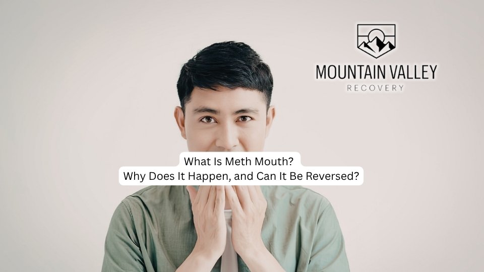What Is Meth Mouth Why Does It Happen, and Can It Be Reversed?